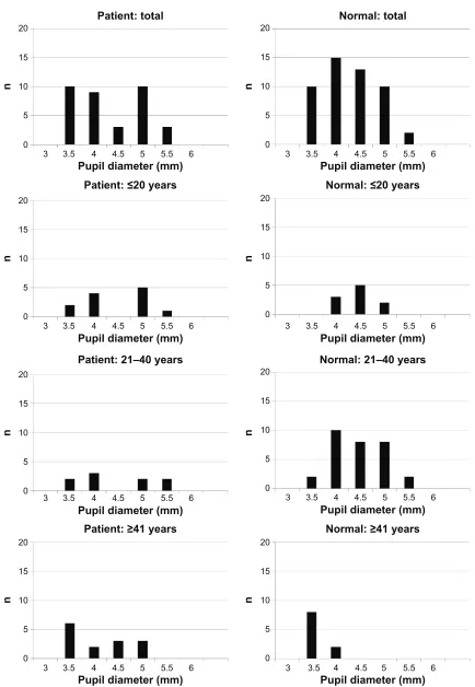 Figure S1 Pupil diameters before recording in patients and controls.Notes: Patients and controls are divided into three age groups: group a #20 years, group B 21–40 years, and group C $41 years