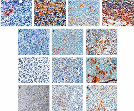 Table 5Frequency of various immunohistochemical patterns of studied gene products in NS and MC cHL