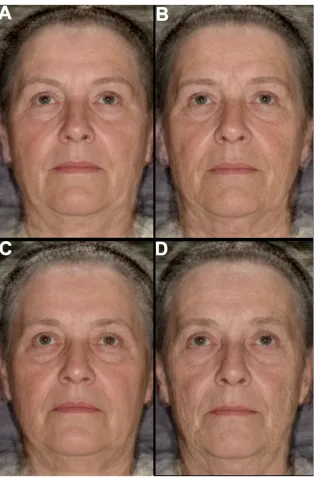 Figure 1. Composite images representing the effects of environmental factors on variation in perceived age between monozygotictwin sisters (upper images) and the effects of environmental and genetic factors on variation in perceived age between dizygotictw
