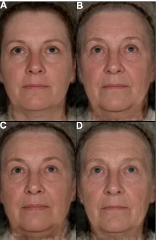 Figure 2. Composite images representing the average differences between 50 and 70 year olds (upper images) and 70 year oldyoung and old looking subjects (lower images) in the British population.[48–52]) and70 year olds (mean perceived age 73 [67–79]) compo