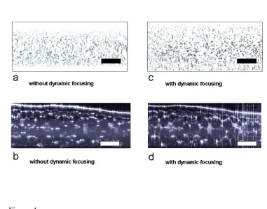 Figure 4 Dynamic focusing increases the depth of field, in (a) only middle region is 
