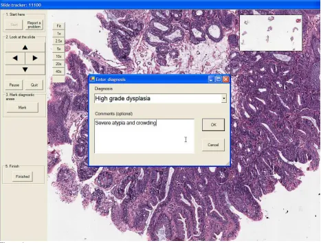 Figure 1Virtual slide viewing software. The virtual slide is displayed in the centre. The usernavigates using the arrow buttons on the left of the screen, keyboard and mouse.