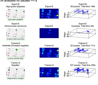 Figure 2Example of visualisation produced by analysing tracking data for 4 pathologists viewing