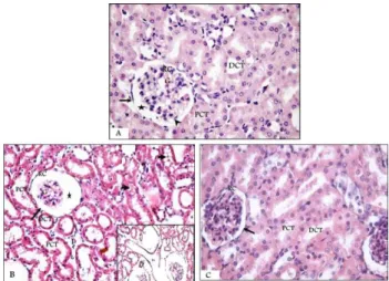 Figure 1: Photomicrographs of H&amp;E stained sections  in the renal cortex of A): Control group, showing 