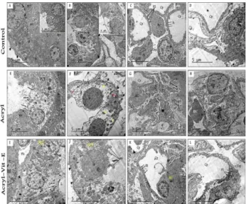 Figure 5 (A-D): Electron micrographs of control  kidney. 