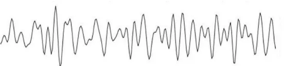 Figure 2.1: Alpha waves. [8] 