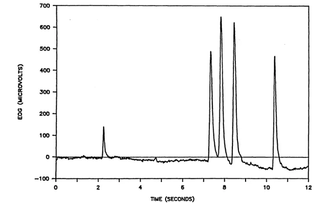 Figure 6.3 Vertical right EOG. 