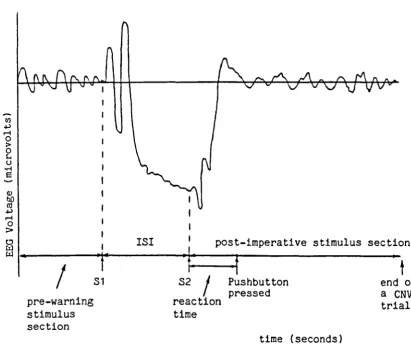 Figure 2.6 A Schematic drawing of a preprocessed averaged CNV waveform. 