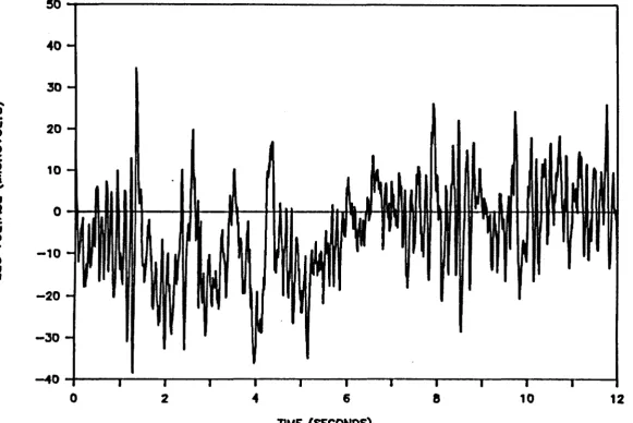 Figure 2.8 The CNV response in a schizophrenic patient. 