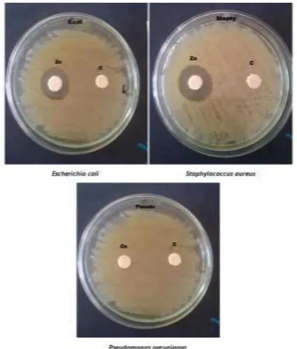 Figure 6: Antimicrobial activity of Zinc nanoparticles withEscherichia coli, Staphylococcus aureus and Pseudomonas aeruginosa