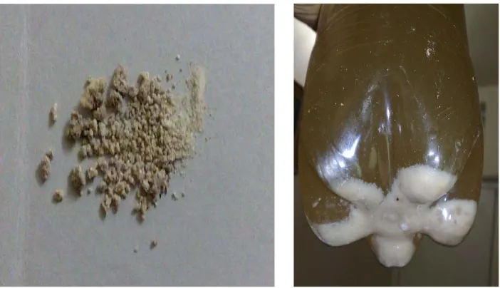 Figure 1. Types of gravels post ESWL 1st picture reveals macroscopic gravels, 2nd stone frag- mented into sand like material