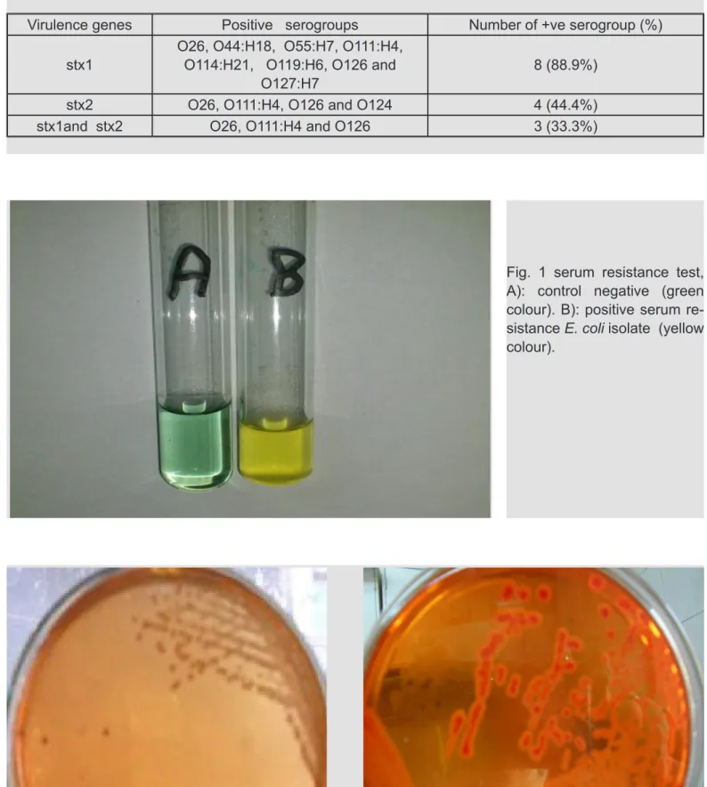 Table 5 Stx1 and stx2 genes profile of different nine E. coli strains isolated from clinical mastitic cow’s milk  samples.