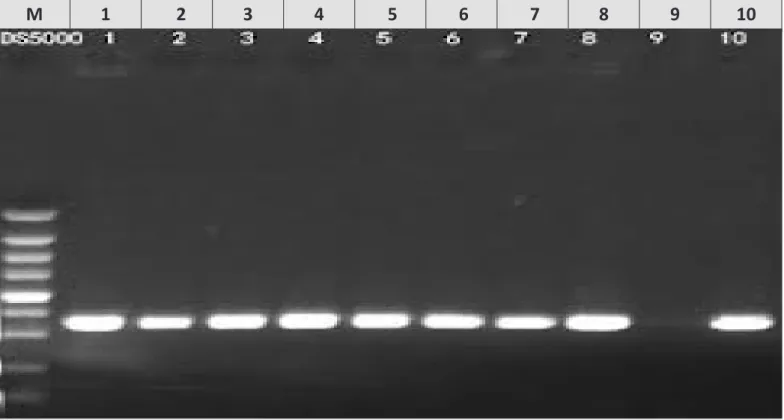 Fig. 3 Agarose gel electrophoresis of PCR amplification products using Shiga toxin 1 (stx1) primers of  E