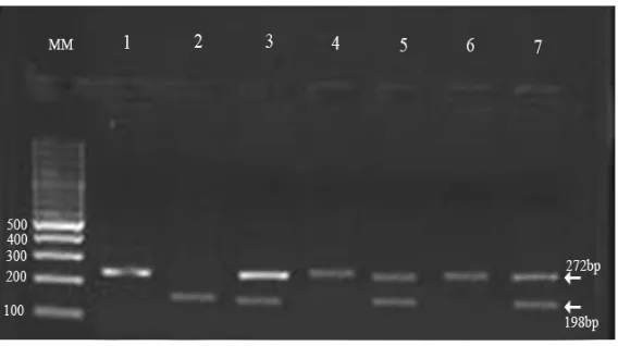 Figure 1. FokI RFLP of VDR gene Lane 1, 4, 6 show FF genotype, Lane 2 show ff genotype, Lane 3, 5, 7 show Ff genotype