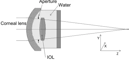 Figure 1 Model eye and optical path diagram of an iOl without misalignment.Abbreviation: iOl, intraocular lens.