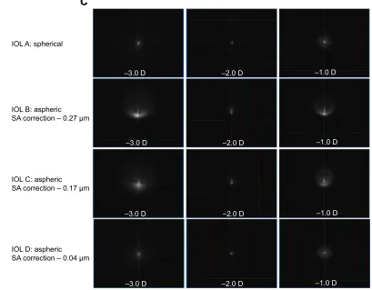 Figure 4 Defocused PsF images for iOls in a water-immersed model eye (pupil diameter 6 mm).Notes: (A) Without misalignment; (B) with a decentration of 0.5 mm; and (C) with a tilt of 0.5°