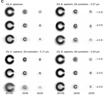 Figure 5 landolt ring simulations corresponding to iOls in a water-immersed model eye (pupil diameter 6 mm).Notes: (A) Without misalignment; (B) with a decentration of 0.5 mm; and (C) with a tilt of 0.5°