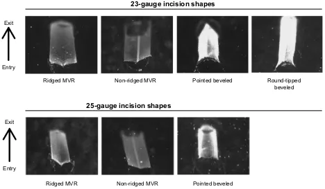 Figure 4 incision shape of 23- and 25-gauge blades with straight incision at the entry site.Notes: The incision shapes of 23- and 25-gauge blades were linear and slit-like with the ridged MVR blades, flattened “M”-shaped with the non-ridged MVR blades, che