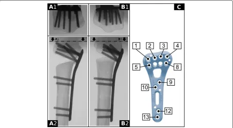 Fig. 1 Outline of the 100 % (group A) and 75 % distal screw length (group B) setups.distal screw length (Group B)