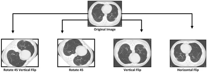 Fig. 5. Perform augmentation methods to increase limited COVID-19 CT scan images 