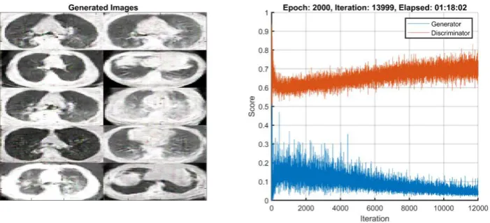 Fig. 6. Conditional Generative Adversarial Network model 