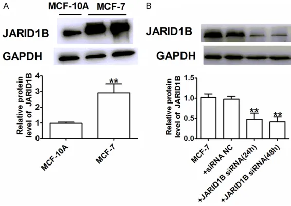 Figure 2. The establishment of stable JARID1B transfection in breast can-cer cell lines
