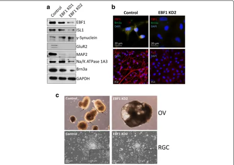 Fig. 7 Effect of knockdown of EBF1 on differentiation of RGCs. a Western blot analysis demonstrating expression levels of EBF1 and indicated RGCmarkers in RGCs differentiated from control and EBF1 knockdown (EBF KD1 and EBF KD2) hiPSCs