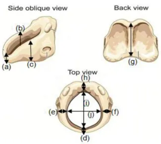 Figure 1 (A and B): Electronic digital caliper used in  this study and its schematic representation