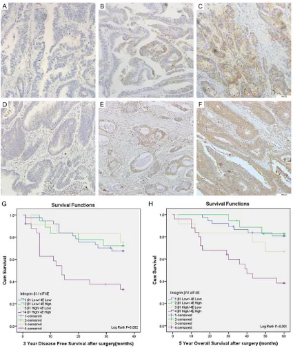 Figure 1. tively (Scale bar 100 μm). G and H. Represent patients’ 3-Year relapse free survival and 5-Year overall survival ac-eIF4E and Integrin β1 expressions and patients’ survival in human colorectal cancer