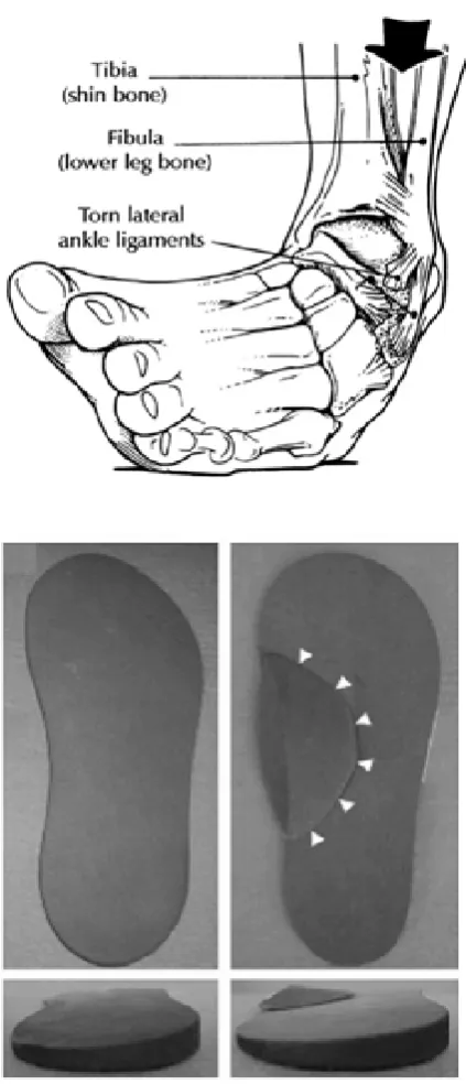 Figure 4.3.3 (Top) illustration of inversion sprain; (bottom) eversion (lateral wedge) insole (6°) with (right) and without (left) medial arch-support (Nakajima et al., 2009) 