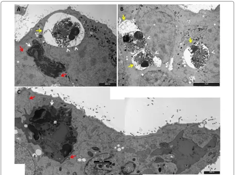 Figure 9 Live and apoptotic neutrophils in human urinary epithelial cells. Isolated fresh bovine blood neutrophils were placed on a monolayer of human urinary epithelial cell line 5637 grown on glass cover slides in 24 wells culture plate