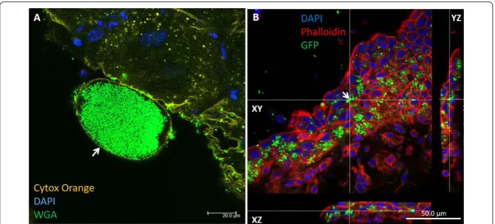 Figure 2 CFUs of mounts of gall bladder were stained with DAPI (blue in demonstrates IBC of GFP-expressing bacteria in gall bladder epithelial cells