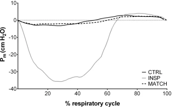 Fig 1. Representative data of the effects of inspiratory muscle loading (INSP) on mouth pressure (Pm) comparedto control (CTRL) and work matched (MATCH) exercise conditions.