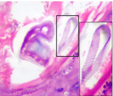 Figure 2. Illustrate Visible DNA helical like bands, structural platform of the embryoid bodies