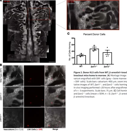 Figure 2. Donor KLS cells from WT, βtative images of WT, In vivo imaging performed +20 hours after engraftment