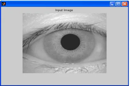 Figure 1 Original Eye Image 