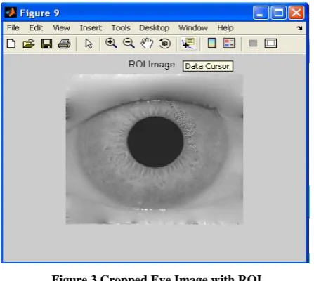 Figure 3 Cropped Eye Image with ROI  