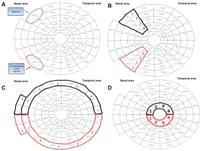 Figure 1 The 58 segments of the right visual field. The field is divided into two identical hemifields across the horizontal meridian; each segment has a similar correspondent in the opposite hemifield (A) the SNR value is calculated in each segment