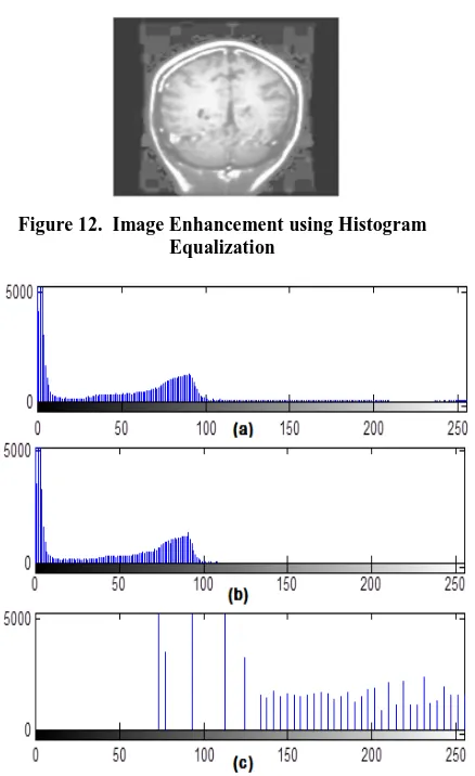 Figure 12.  Image Enhancement using Histogram Equalization 
