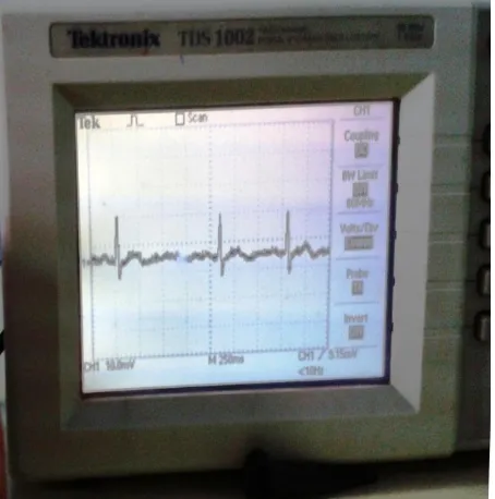 Fig 2: Observed noisy signal on the Oscilloscope 