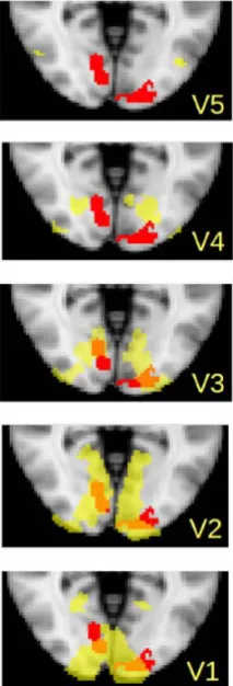 Figure 3. Cortex imaging. Images of occipital cortex showing the significant activation of voxels in the visual areas that responded to the “far” stimuli more than to the “near” stimuli
