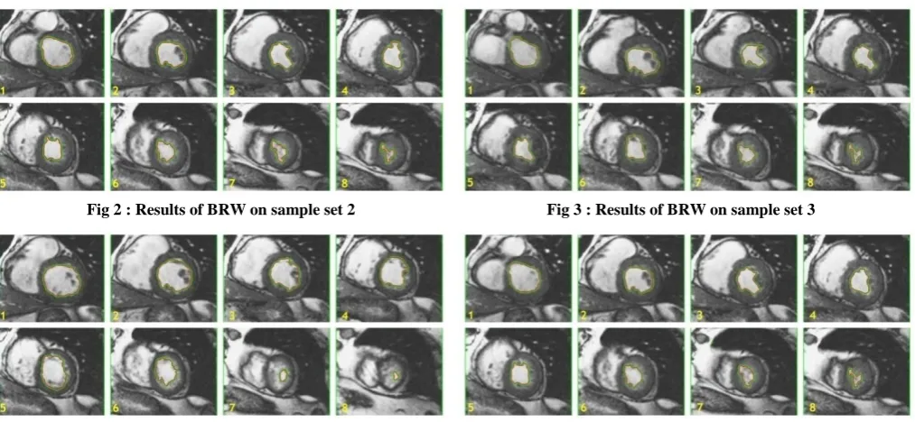 Fig 2 : Results of BRW on sample set 2 