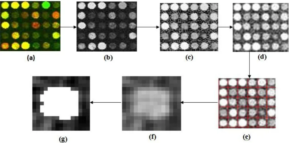 Fig. 3.  Stages of the Proposed Method: Image (a) is the cDNA microarray subimage, (b) is the gray scale image, (c) is the enhanced image, (d) is the denoised image, (e) the gridded image, (f) the extracted cell (spot and its background), and (g) is the 