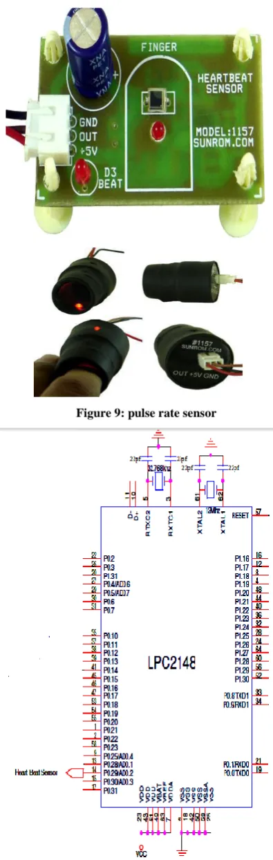 Figure 9: pulse rate sensor 