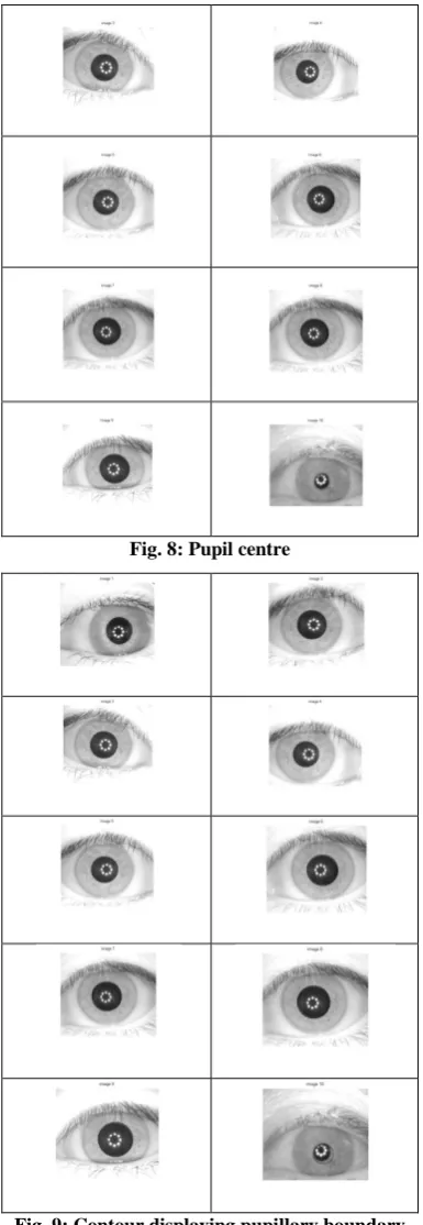 Fig. 10: Contour displaying iris boundary 