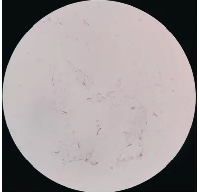 Table 3. The examination time for membra- ground of the smear prepared with membra- ne-based smear microscopy are shown in Figure 1Significantly, the difference in the examina-tion times between the two methods was la- rgely attributable to the shortening 