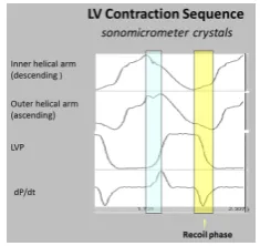 Figure 9. Left ventricular contraction sequence by anterior LV sonomicrometer crystals