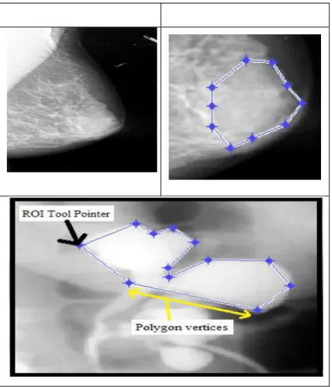 Fig.1 exhibits the different essential functionality of the proposed system where the major stress is on performing compression technique on medical images using region of 