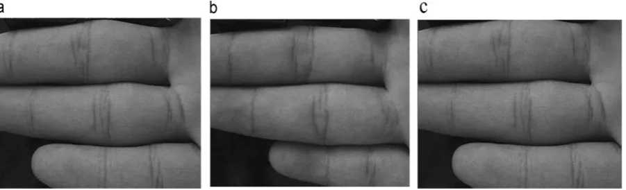 Fig. 4 Sample IKP images 