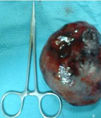 Figure a: pièce d’ovariectomie droite.  